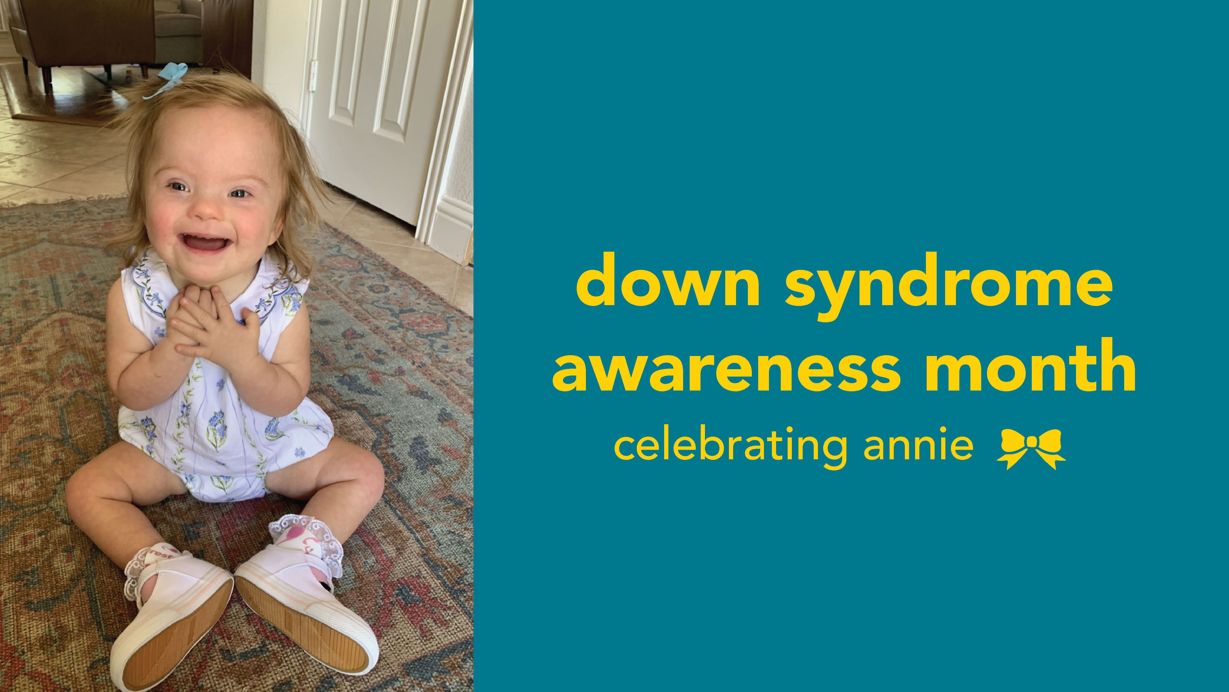 kids with translocation down syndrome