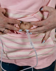 Closeup of abdomen access with tubing