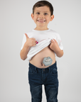Boy holding up shirt to display gray g-tube pad in use