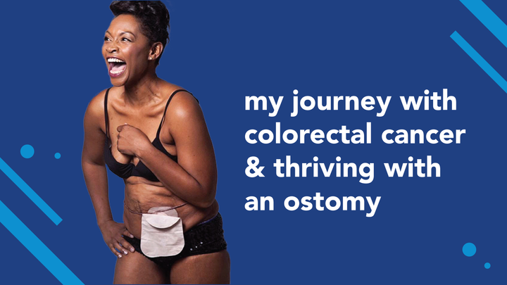 My Journey With Colorectal Cancer & Thriving With an Ostomy 