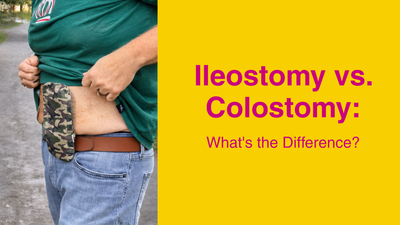 Ileostomy vs. Colostomy: What's the Difference?