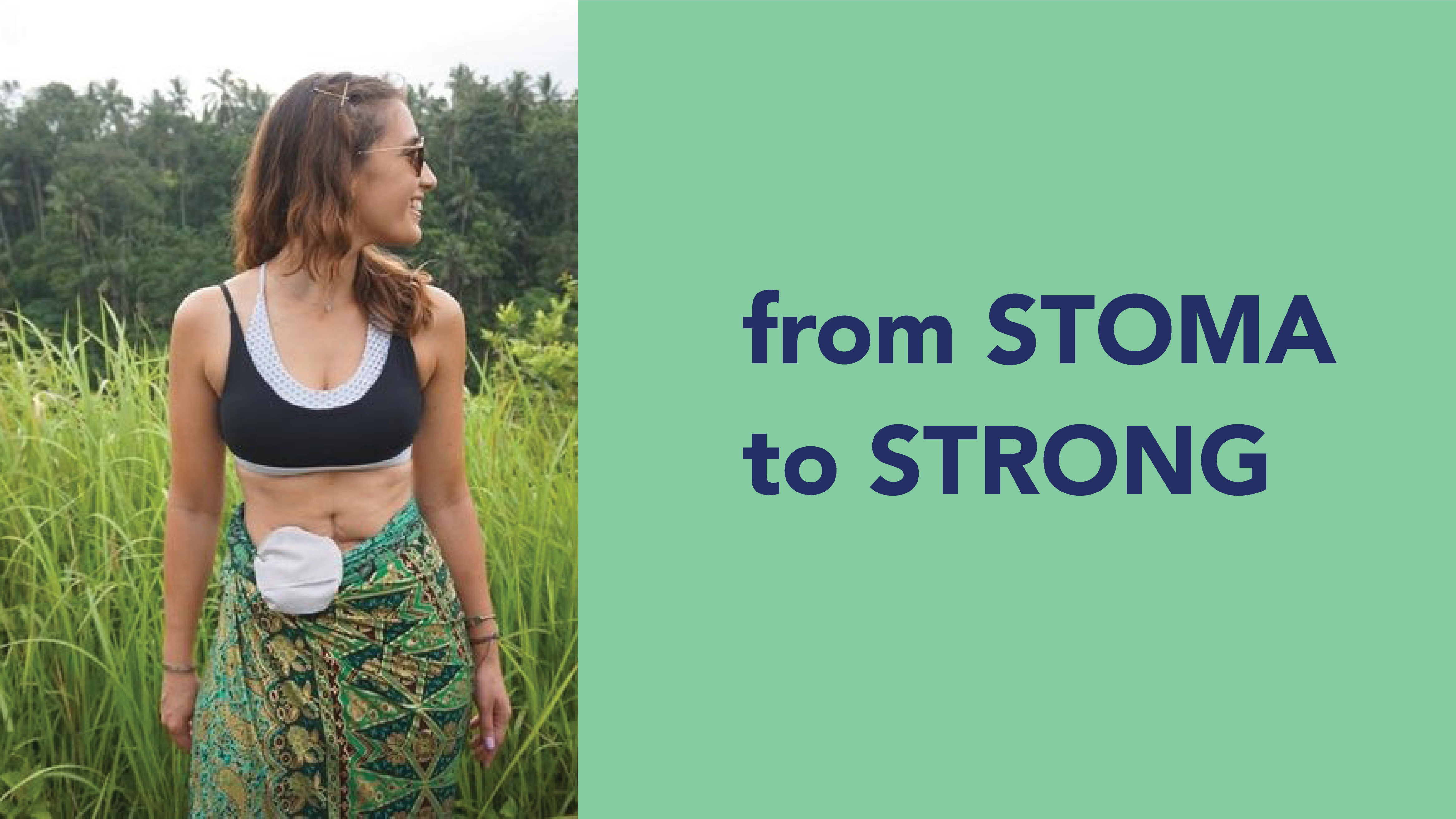 From Stoma to Strong