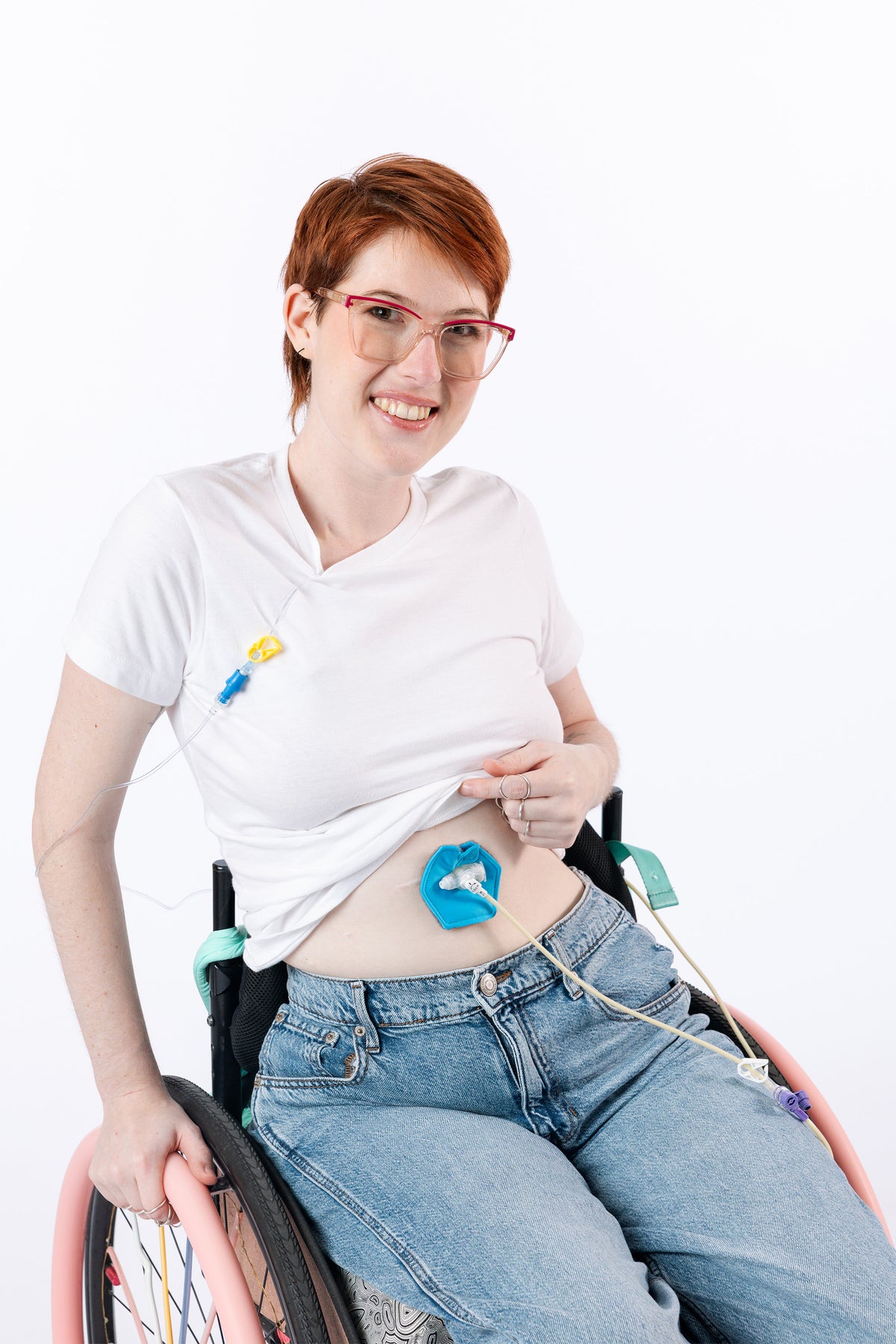 Woman in wheelchair wearing aqua G-Tube Pad