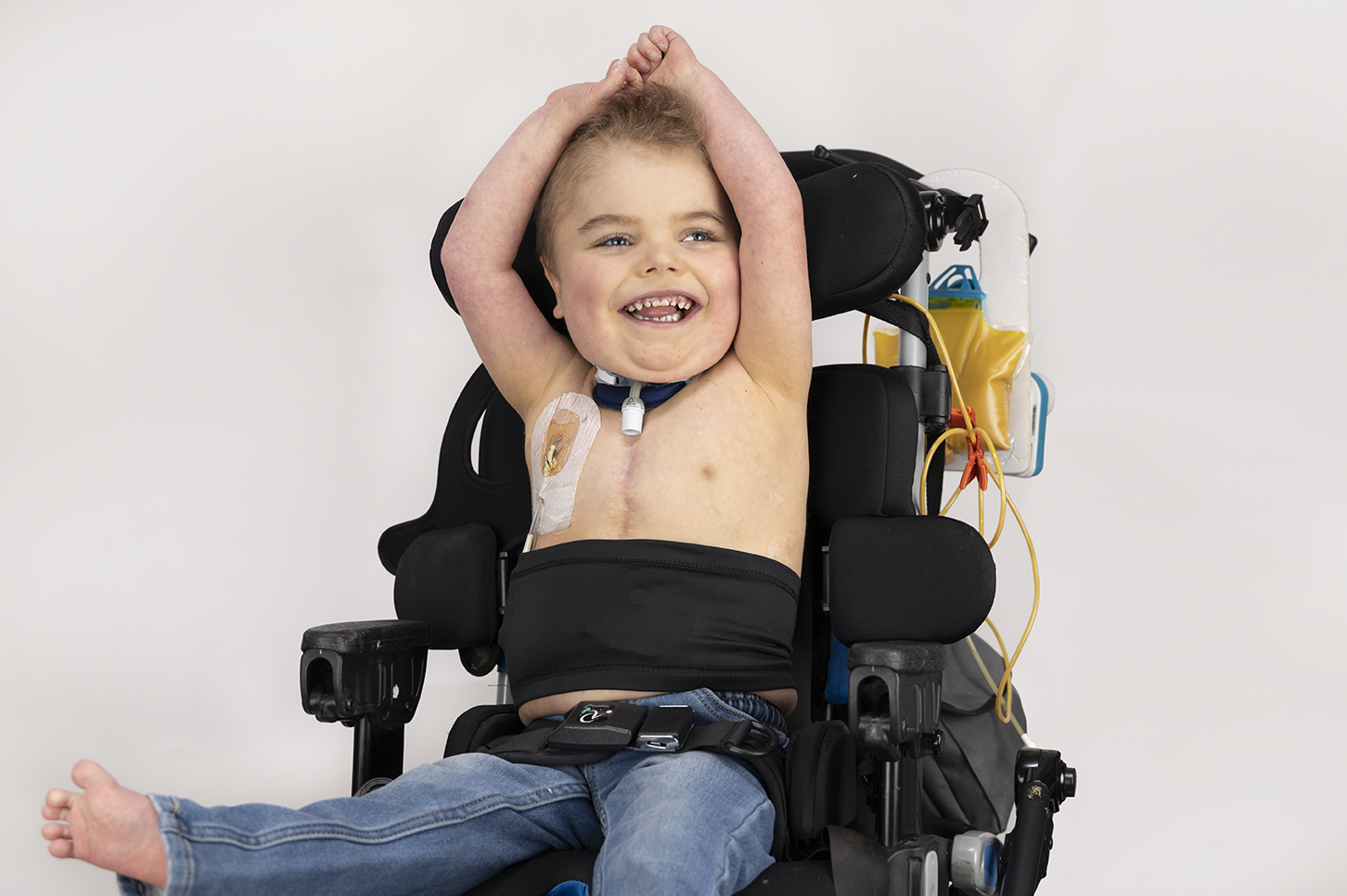 Child sitting in wheelchair wearing black waistband with feeding tube visible 
