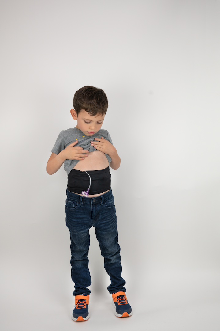 Child standing wearing black waistband with feeding tube visible